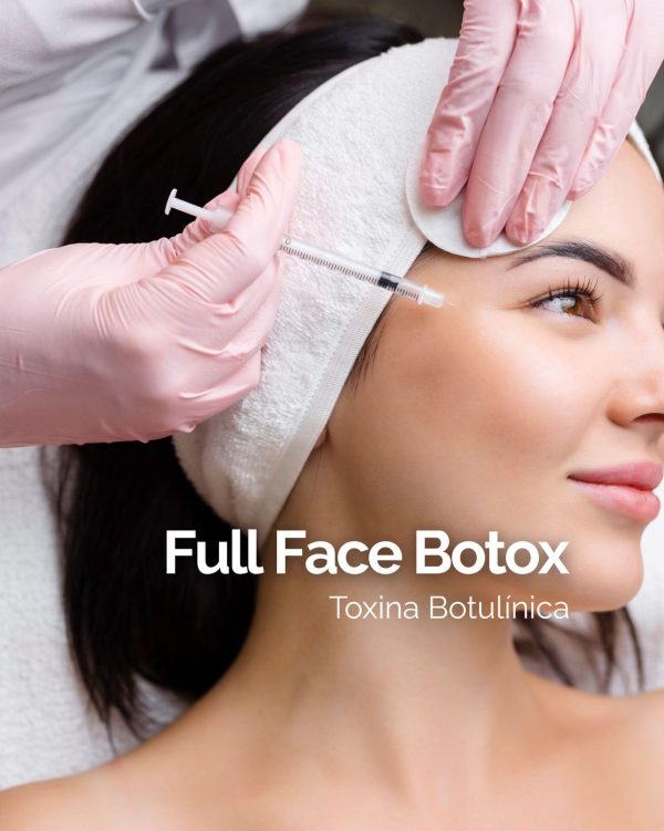 Botox Full Face