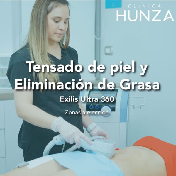 Tensado de piel y Eliminación de Grasa