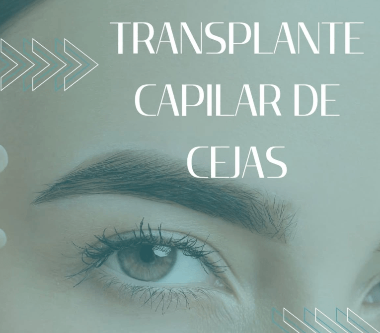 Transplante Capilar de Cejas