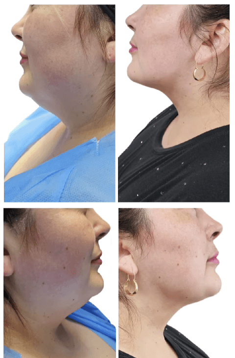 DRAWNFACE (Dra Macarena Gutierrez) - Imagen 2