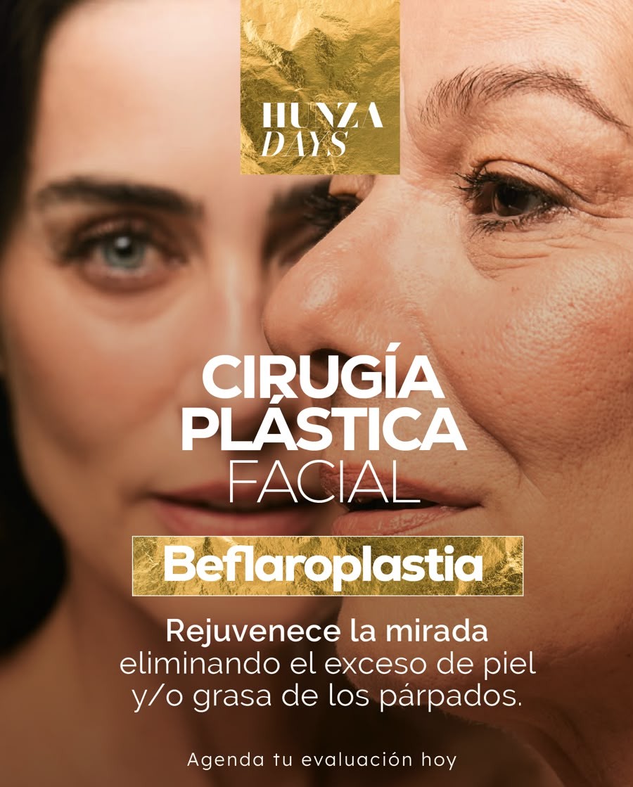 BLEFAROPLASTIA SUPERIOR/INFERIOR