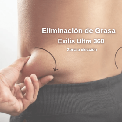 eliminacion de grasa con exilis