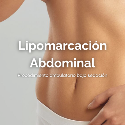 Lipomarcación abdominal (2)